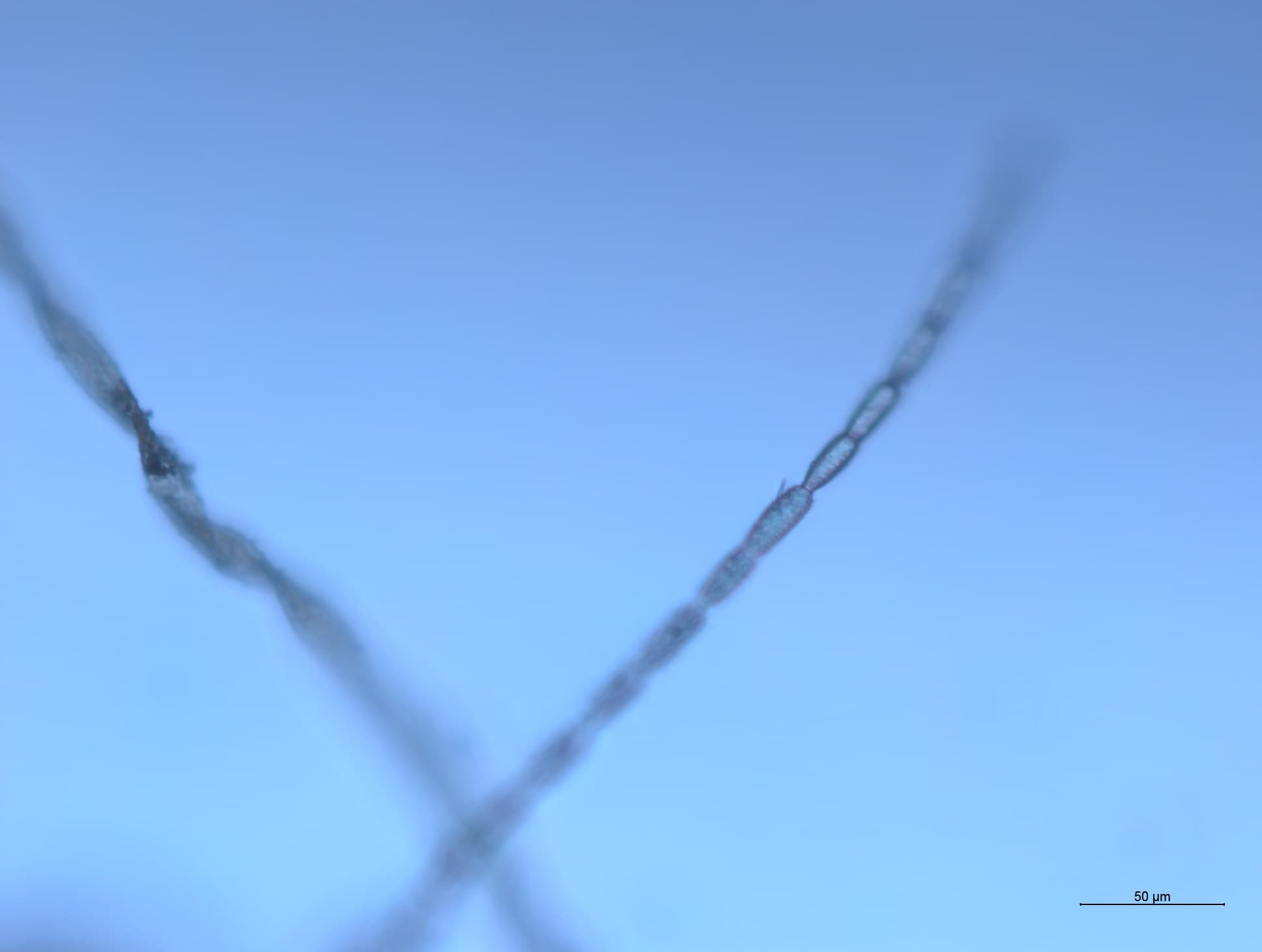 チャタテムシの接写画像 9